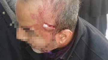 حادث عنيف: والد يهاجم معلم طالبة بآلة حادة بالإسماعيلية